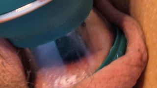 1000056401.mp4